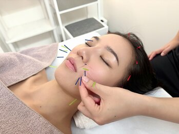 ニシジン キュアラボ(NISHIJIN CURE Labo)の写真/冬の寒さに負けない肌作りを！全身調整鍼で内側からアプローチし、ほうれい線・たるみを改善します☆