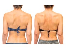 癒和(YUWA)/重りが付いたダルイ肩甲骨周りに