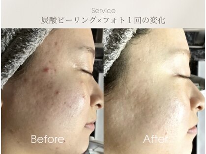 ベルダ(BELDAD)の写真