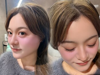 ウェヌス アイ ビューティ(VENUS eye beauty)/アンドヘルシー100本