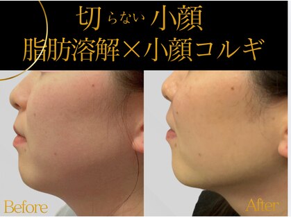 モミン(MOMI.N)の写真