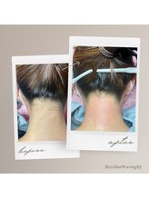 ブラジリアンワキシング シックスナイン(BrazilianWaxing69)/女性 / うなじ