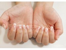 ベールス(Bellus)/ゆきんこネイル