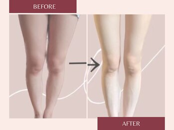 ドットカノア(.Kanoa)/お客様のbefore/after