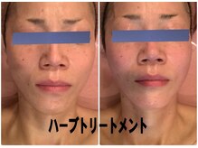 ナチュール(NaTuRu)/リアボーテハーブ正規取り扱い店