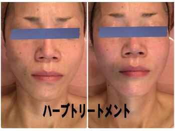 ナチュール(NaTuRu)/リアボーテハーブ正規取り扱い店