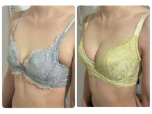 モナンジュ(ramonange)/バストアップbefore after