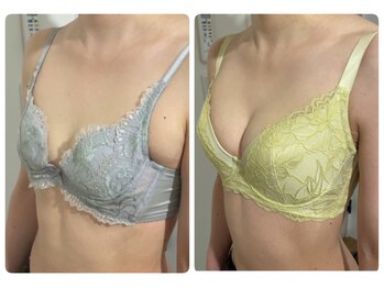 モナンジュ(ramonange)/バストアップbefore after