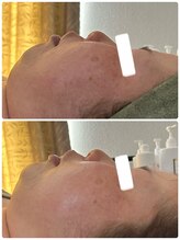 ビジュープラス 幸手店(Bijou+)/スタンダート（オプションなし）