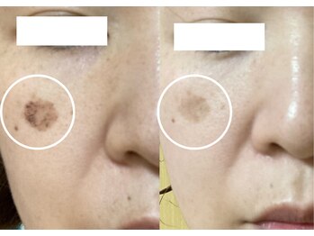 ベリッシモ(bellissimo)