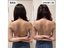 ラバ 名古屋栄店(LAVA)の雰囲気（小顔/小顔矯正/コルギ/痩身/整体/肩こり/骨盤矯正）