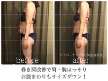 ライフチャージ(Life Charge)/ハイパーナイフBefore→After