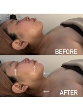 アンミー(anmiiy)/50代エアバリ/首肩頭