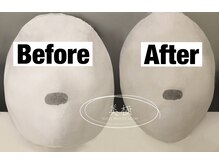 美極 トータルビューティー(美極 TOTAL BEAUTY)/恵比寿/小顔コルギ/エステ/