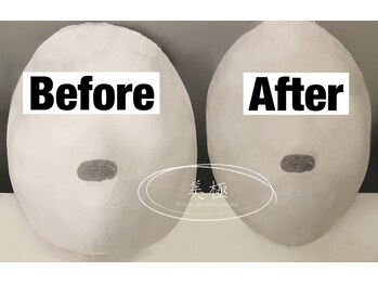 美極 トータルビューティー(美極 TOTAL BEAUTY)/恵比寿/小顔コルギ/エステ/