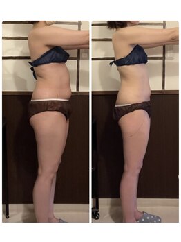 リアン(Liens)/おまかせ全痩身10回の結果