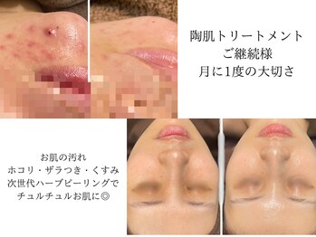 リベェル(Re-Belle)/