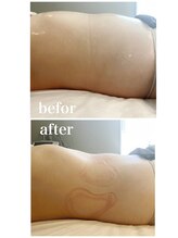 モア 恵比寿(MORE.)/30代後半・１回のみの施術