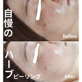 オレオマ(OLEOMA)