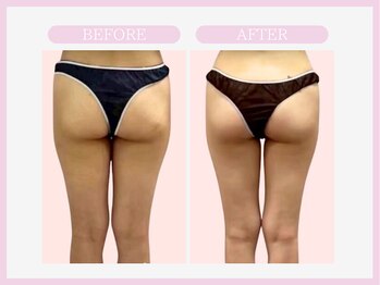 アコガレコガオ 青森店/