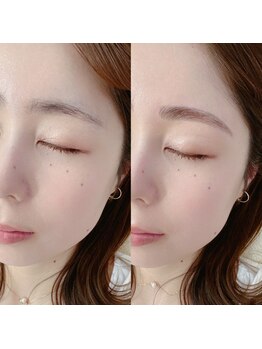 アイル(I’LL)/毛流れ美人眉パーマ