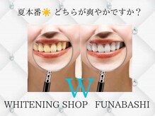 ホワイトニングショップ 船橋店