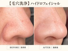 サロン ド ミュゲの雰囲気(毛穴のブツブツが気になったら、ハイドロフェイシャルで毛穴洗浄)