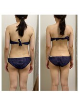 ハピネスビューティーサロン(happiness beauty salon)/WINBACK症例