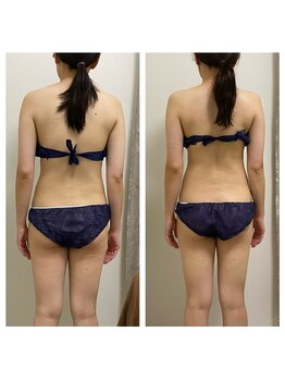 ハピネスビューティーサロン(happiness beauty salon)/WINBACK症例