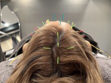 キクキク(KIKUKIKU)/頭美鍼