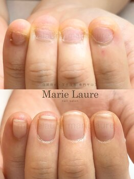 マリーロール 淀屋橋本店(Marie Laure)/自爪育成/深爪矯正/ネイルケア