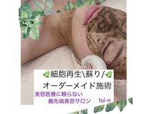 ツイーン