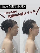 ソルヴィス(SOLVIS)/