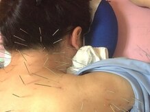 北京堂鍼灸首里 いじゅ治療院