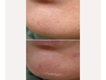 サイ(Sai)/角質を整え一気に艶UP