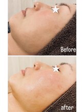 オリエンタル ルボワール(oriental Revoir)/マツヤニホット＆クレイセラピー