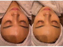 ビュウナ 銀座(BEAUNA)/シルクブライト