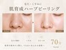 《再来》毛穴・くすみ改善ハーブピーリング70分【Facial】