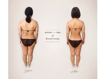 ビューティーチャージ(BeautyCharge)