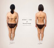 ビューティーチャージ(BeautyCharge)