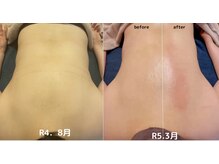 オンリーユータイム(ONLY YOU TIME)/ガチガチな背中