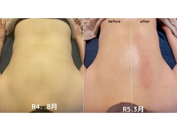 オンリーユータイム(ONLY YOU TIME)/ガチガチな背中