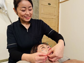 ボディーワークス 新町(BODY WORKS)/おすすめ美容鍼