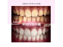 当店No.2人気『回数券10回券』ご契約者様のbefore after◎
