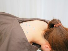 ポプラル鍼灸整体院