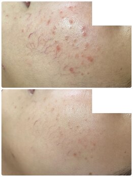 リノ(Lino)/オーダーメイド