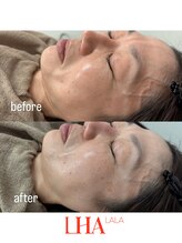 トゥインクル(Twinkle)/くすみ・毛穴・ハリ・ツヤ