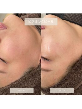 タグ 高知駅前店(Tug)/即効性！ツヤ肌！くすみゼロ！