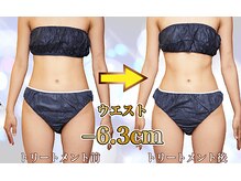 ラグゼ(Beaute Spa LUXE)の雰囲気（プロ機器使用ラジオ波・Wキャビ＆EMSで脂肪もむくみもスッキリ！）
