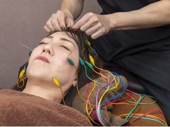 ナチュライズ(NatuRise)の写真/【超リフトアップ美容鍼】は本気で悩む30代半ば以降の方におすすめ◎ストレス抑制や自律神経も同時に調整♪